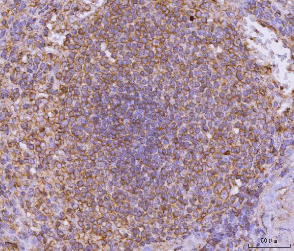  IHC analysis of CD135/FLT3 using anti-CD135/FLT3 antibody (A00188-5)