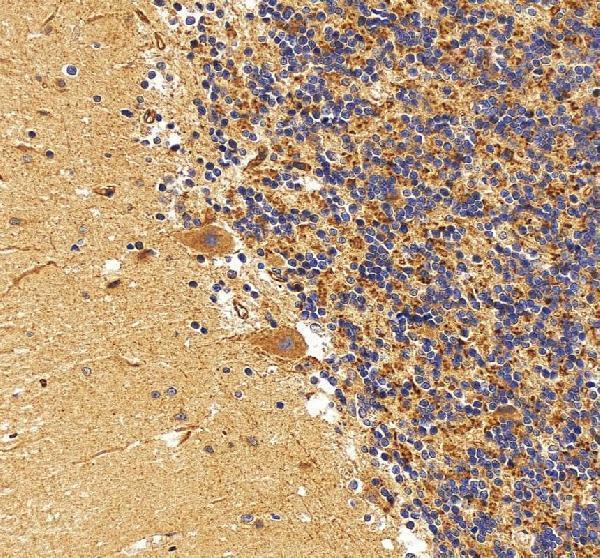IHC analysis of FLT3 using anti-FLT3 antibody (A00188-5)