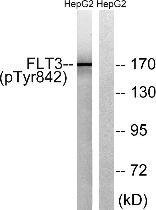 Western blot analysis of lysates from HepG2 cells treated with EGF 200ng/ml 30