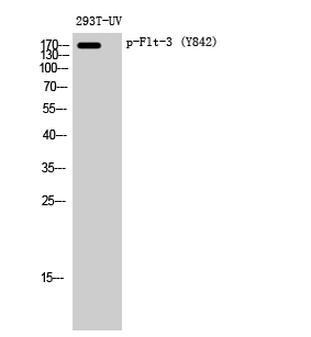 Western Blot analysis of 293T-UV cells using Phospho-Flt-3 (Y842) Polyclonal Antibody diluted at 1:1000