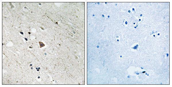 a00188y969 flt3 primary antibodies ihc testing 3