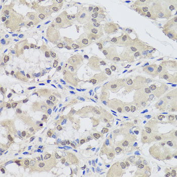 a00189 ago2 primary antiboties ihc testing 2