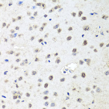 a00189 ago2 primary antiboties ihc testing 3
