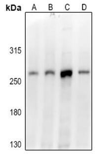 Western blot (WB) analysis of DICER1 pAb at 1:500 dilution
LaneA:The Testis tissue lysate of Mouse(40ug)
LaneB:EC9706 whole cell lysate(40ug)
LaneC:HEK293T whole cell lysate(40ug)
LaneD:MCF-7 whole cell lysate(40ug)