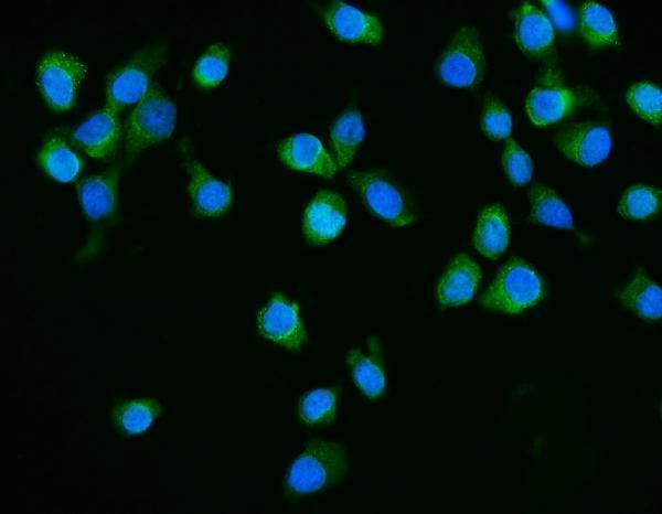  IF analysis of Dicer/DICER1 using anti-Dicer/DICER1 antibody (A00190-2)