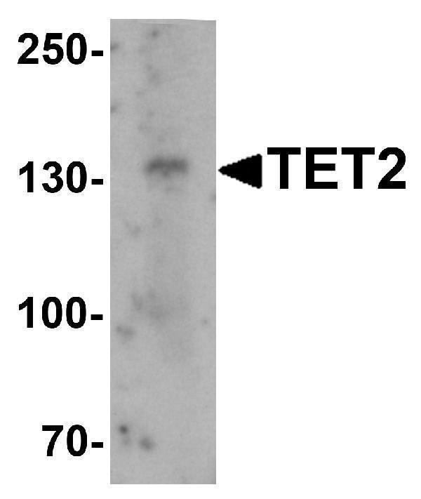 Western blot analysis of TET2 in SK-N-SH cell lysate with TET2 antibody at 1 μg/mL
