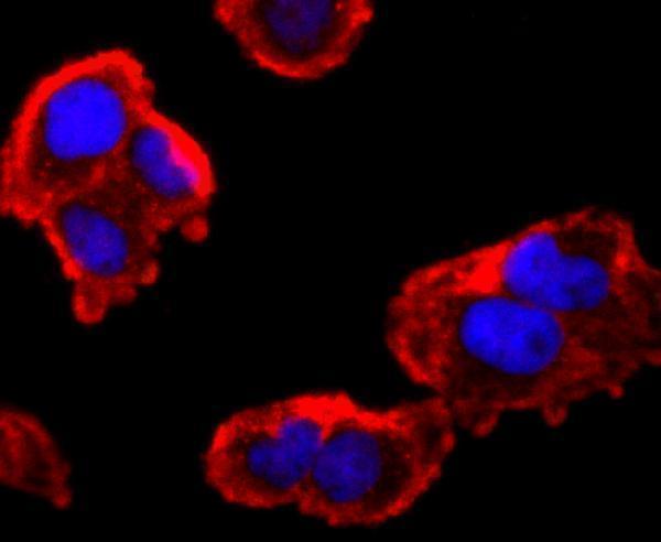 ICC staining FMRP in Hela cells (red)