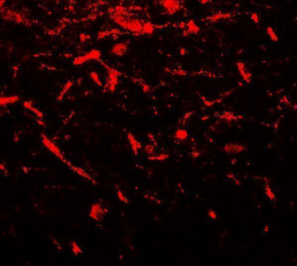 Immunofluorescence of FMR1 in human brain tissue with FMR1 antibody at 20 μg/mL