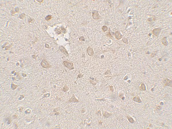 Immunohistochemistry of FMR1 in human brain tissue with FMR1 antibody at 2