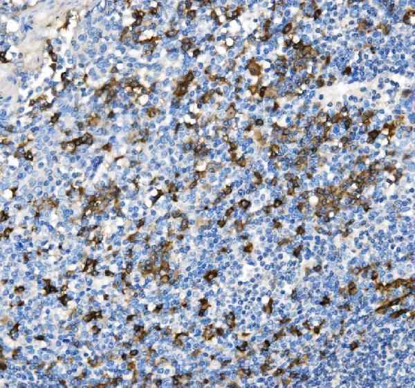 a00193 3 cd38 primary antibodies ihc testing 2