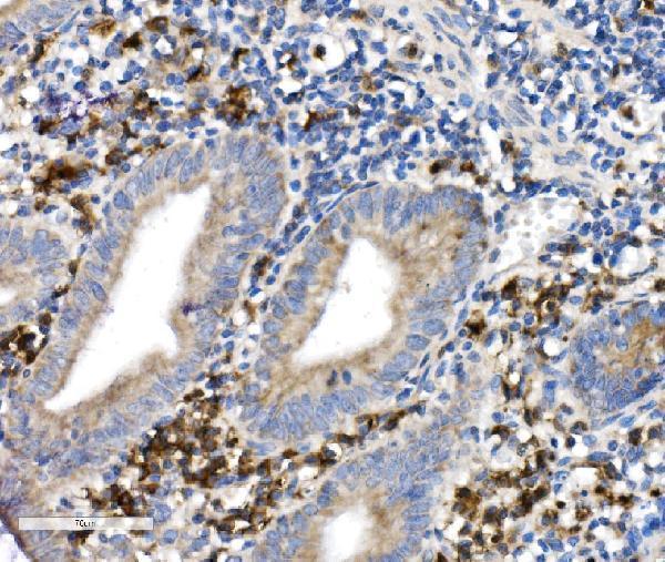 a00193 3 cd38 primary antibodies ihc testing 3