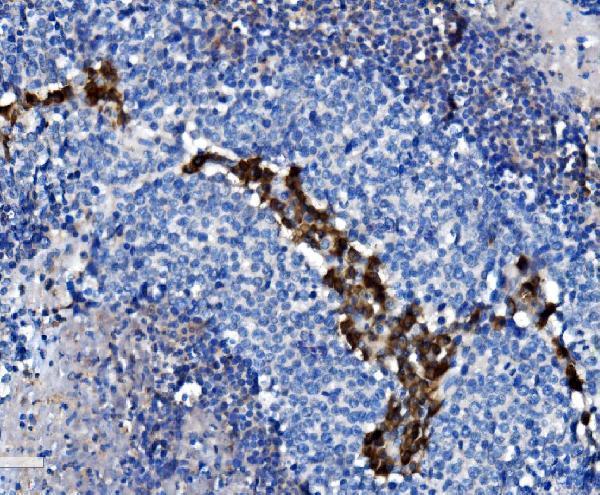 a00193 3 cd38 primary antibodies ihc testing 4