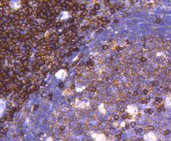 Immunohistochemical analysis of paraffin-embedded human tonsil tissue using anti-CD38 antibody