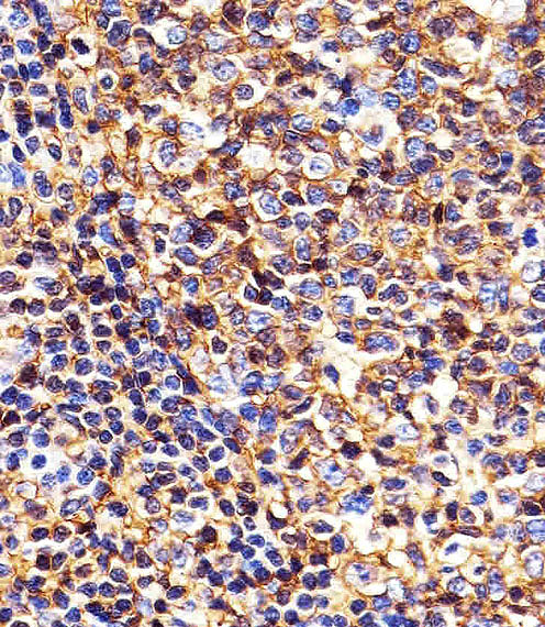 Immunohistochemical analysis of paraffin-embedded H