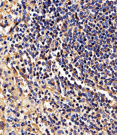 a00194 1 anti hla b antibody n term ihc p testing 4