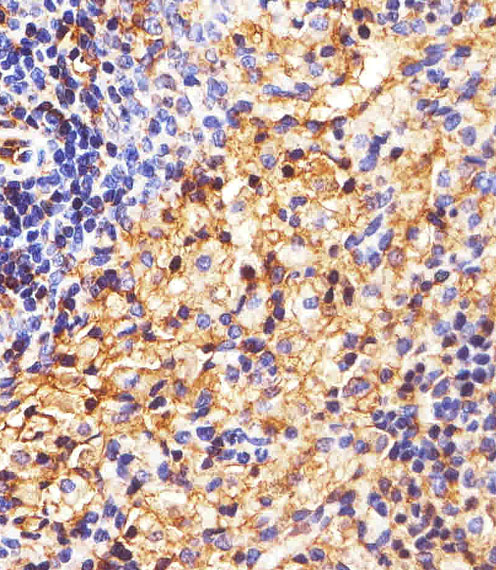 a00194 1 anti hla b antibody n term ihc p testing 5