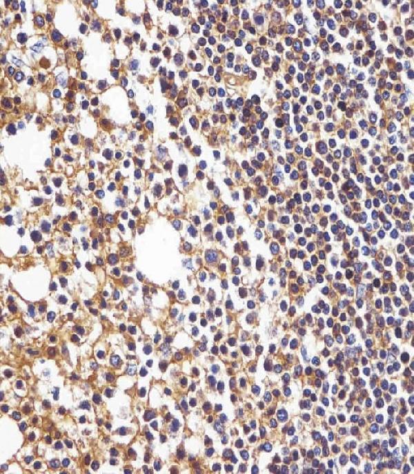 a00194 1 anti hla b antibody n term ihc p testing 6