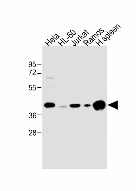 All lanes : Anti-HLA-B Antibody (N-term) at 1:1000 dilutionLane 1: Hela whole cell lysateLane 2: HL-60 whole cell lysateLane 3: Jurkat whole cell lysateLane 4: Ramos whole cell lysateLane 5: human spleen lysateLysates/proteins at 20 µg per lane