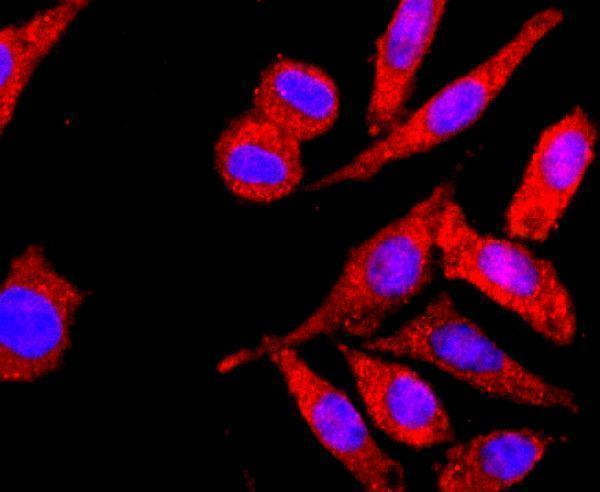 ICC staining MHC class I in SH-SY-5Y cells (red)