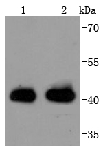 Western blot analysis of MHC class I on different lysates using anti-MHC class I antibody at 1/1,000 dilution