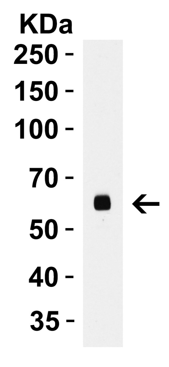  WB Validation in Human Thymus
Loading: 15 μg of lysate Antibodies: CD80, A00196, 2 μ g/mL , 1 h incubation at RT in 5% NFDM/TBST