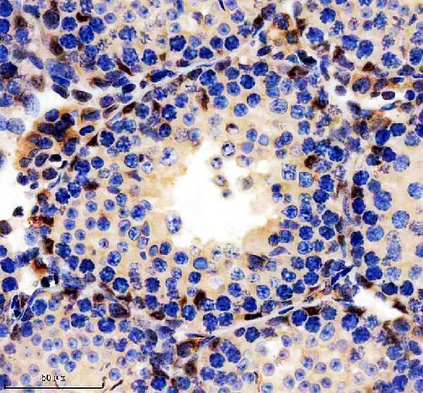 IHC analysis of WT1 using anti-WT1 antibody (A00199-2)