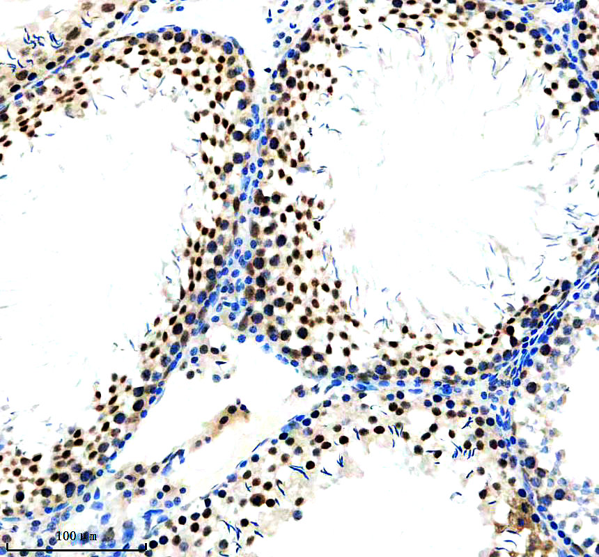 IHC analysis of WT1 using anti-WT1 antibody (A00199-2)