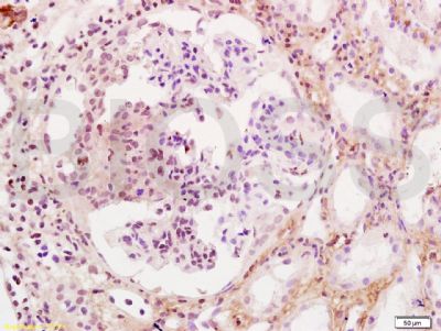 a00199 wt1 primary antiboties ihc testing 3