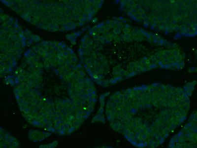 a00199 wt1 primary antiboties ihc testing 4