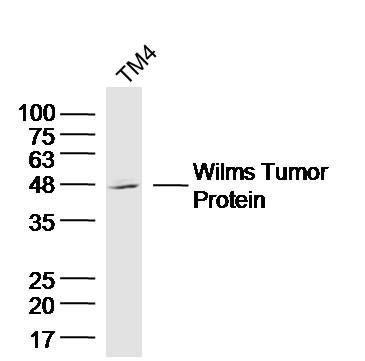 a00199 wt1 primary antiboties wb testing 1
