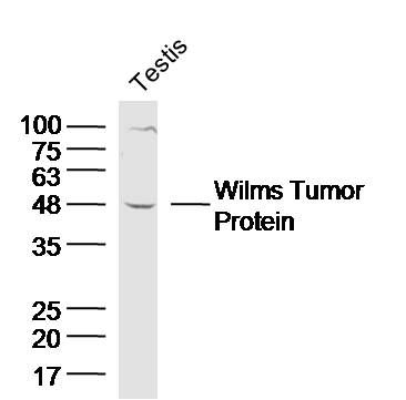 a00199 wt1 primary antiboties wb testing 2