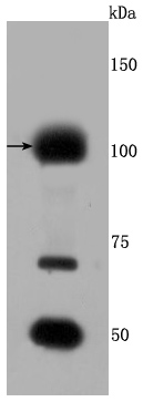a00200 1 fgfr3 primary antiboties wb testing 1