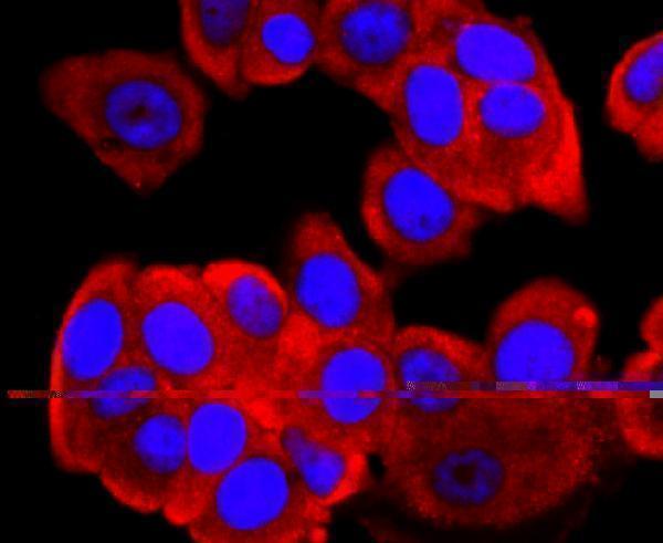 a00200 2 fgfr3 primary antiboties icc testing 2