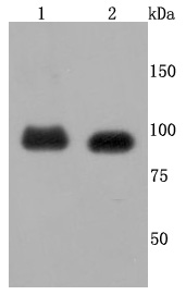 a00200 2 fgfr3 primary antiboties wb testing 1