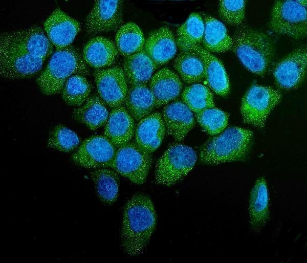 a00201 2 pink1 primary antibodies if testing 2