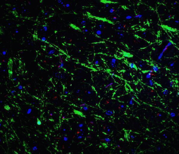 a00201 pink1 primary antibodies if testing 3