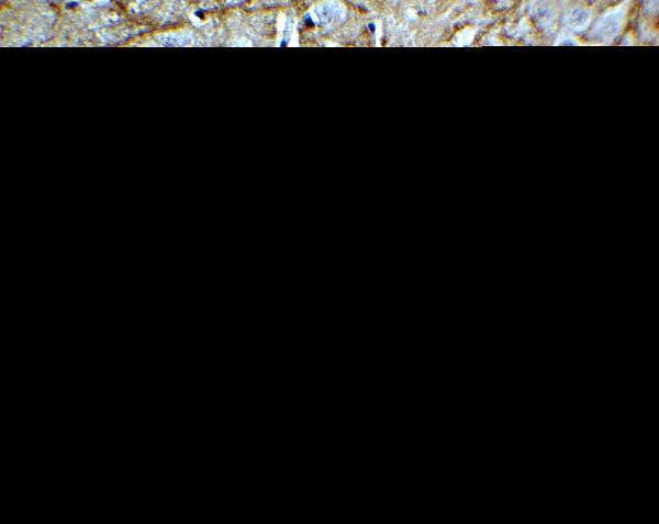 a00201 pink1 primary antibodies ihc testing 2