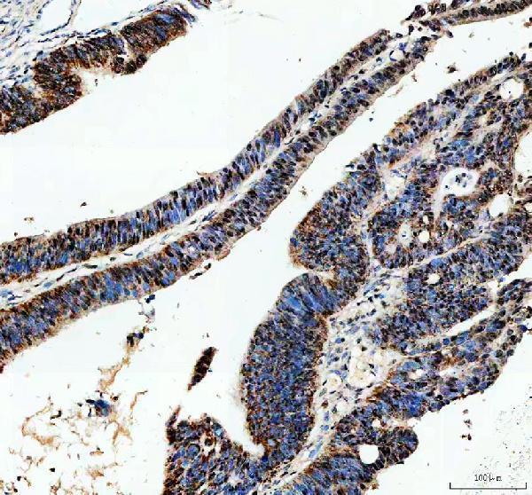 a00203 2 atrx primary antibodies ihc testing 1