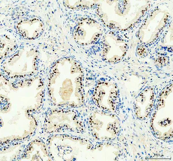 a00203 2 atrx primary antibodies ihc testing 2