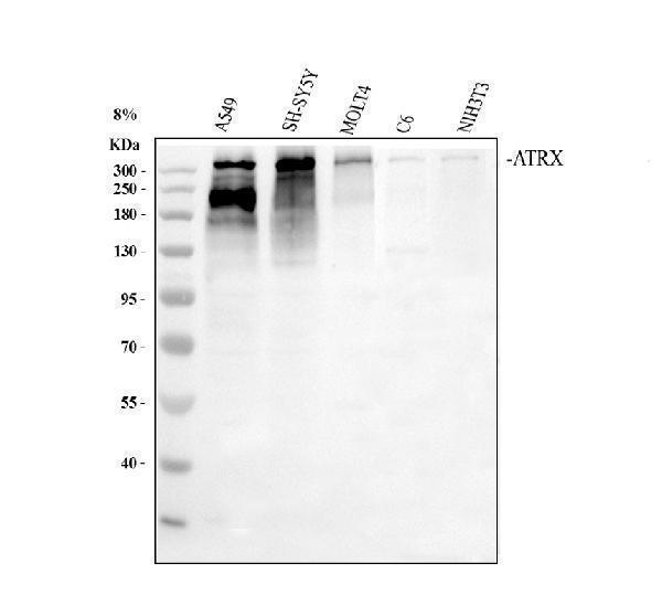 a00203 2 atrx primary antibodies wb testing 1