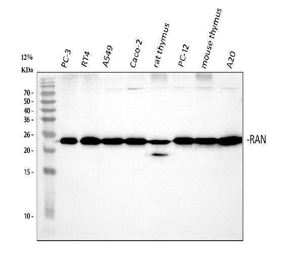  Western blot analysis of Ran using anti-Ran antibody (A00204-1)