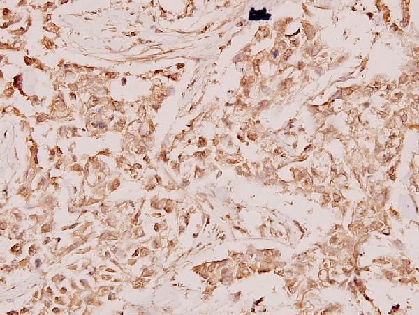 a00204 ran primary antiboties ihc testing 2