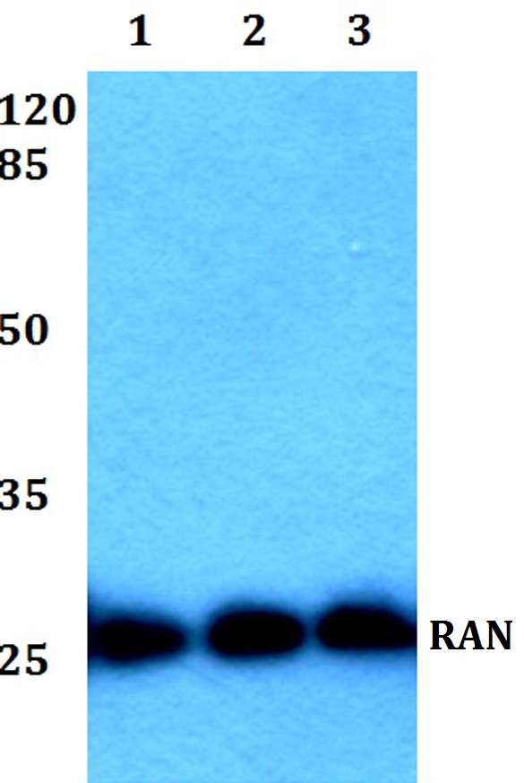 a00204 ran primary antiboties wb testing 1