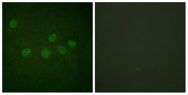 a00205 1 crebbp primary antibodies if testing 1