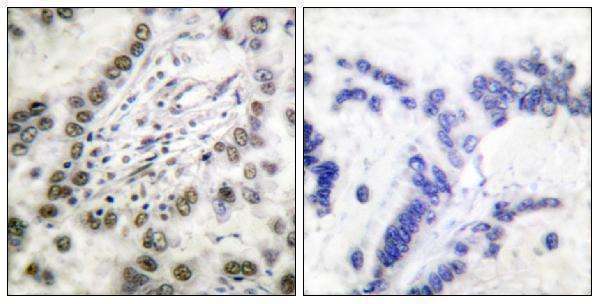 a00205 1 crebbp primary antibodies ihc testing 4