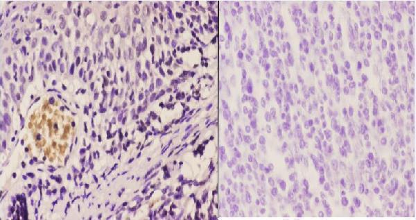 Immunohistochemistry (IHC) analyzes of CBP (E1528) pAb in paraffin-embedded human tonsil carcinoma tissue at 1:50
