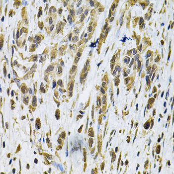 Immunohistochemistry of paraffin-embedded human placenta using RhoA Rabbit pAb  at dilution of 1:100 