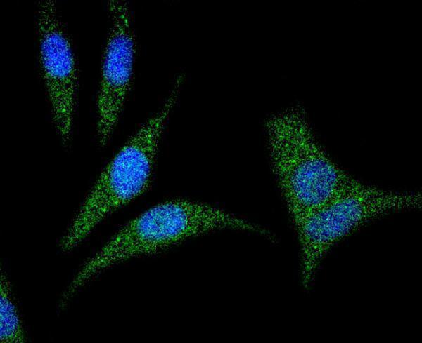 ICC staining RhoA in SH-SY-5Y cells (green)