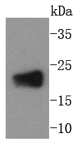 Western blot analysis of RhoA on rat brain lysates using anti-RhoA antibody at 1/1,000 dilution