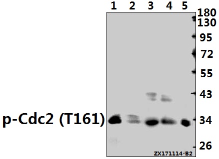 Western blot (WB) analysis of Cdk1/Cdc2 (phospho-T161) polyclonal antibody at 1:500 dilution
Lane1:PC12 whole cell lysate(40ug)
Lane2:3T3-L1 whole cell lysate(40ug)
Lane3:HEK293T whole cell lysate(40ug)
Lane4:MCF-7 whole cell lysate(40ug)
Lane5:PC3 whole cell lysate(40ug)